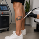 Does Laser Tattoo Removal Hurt? What to Really Expect